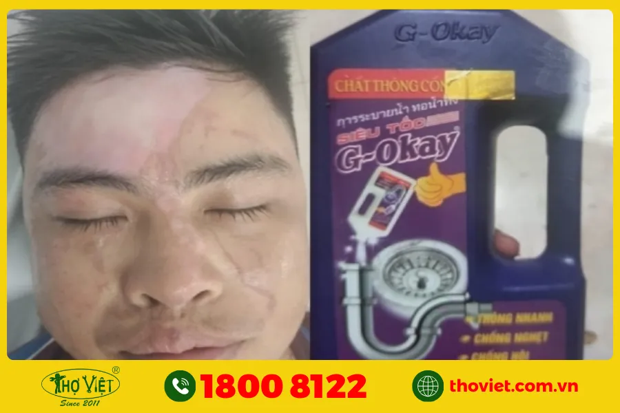 Tác hại của nước thông cống Sifa khi sử dụng không đúng cách